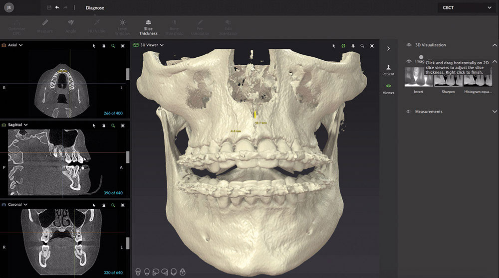 立体的に顎の特徴を捉える「CT分析」